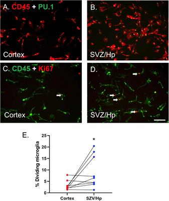 Distinct characteristics of microglia from neurogenic and non-neurogenic regions of the human brain in patients with Mesial Temporal Lobe Epilepsy